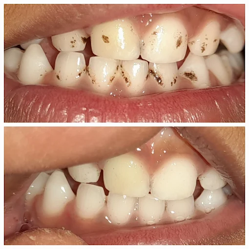Pooja Smile Care Dental Gallery Image 20